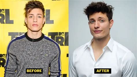 matt rife glow up